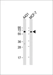 Anti-Paxillin antibody used in Western Blot (WB). GTX81889