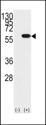 Anti-YB1 antibody, N-term used in Western Blot (WB). GTX81910