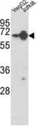 Anti-hnRNP L antibody, Internal used in Western Blot (WB). GTX81941