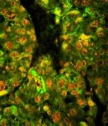 Anti-CD38 antibody, C-term used in IHC (Paraffin sections) (IHC-P). GTX81962