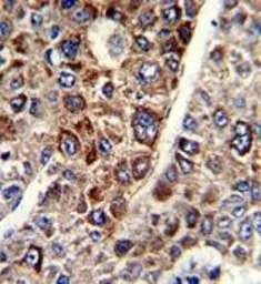 Anti-CD38 antibody, C-term used in IHC (Paraffin sections) (IHC-P). GTX81962