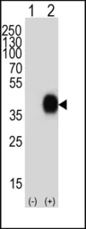 Anti-CD38 antibody, C-term used in Western Blot (WB). GTX81962