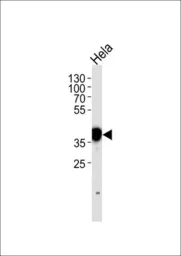 Anti-Nucleophosmin antibody, N-term used in Western Blot (WB). GTX81996