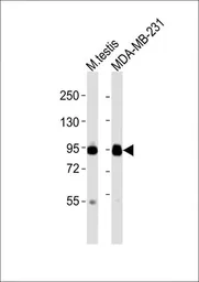 Anti-EZH2 antibody used in Western Blot (WB). GTX82503