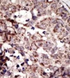 Anti-RAGE antibody, N-term used in IHC (Paraffin sections) (IHC-P). GTX82505