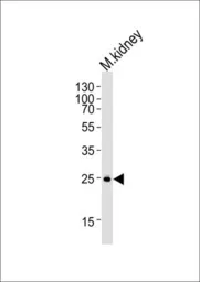 Anti-SNAI1 antibody, N-term used in Western Blot (WB). GTX82509