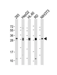 Anti-EIF4E2 antibody used in Western Blot (WB). GTX82524