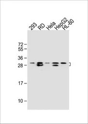 Anti-EIF4E2 antibody used in Western Blot (WB). GTX82524