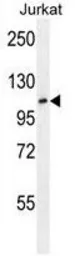Anti-FBXL11 antibody, Internal used in Western Blot (WB). GTX82550