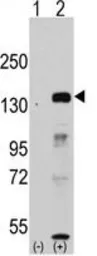 Anti-FBXL11 antibody, Internal used in Western Blot (WB). GTX82550