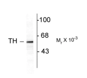 Anti-Tyrosine Hydroxylase antibody used in Western Blot (WB). GTX82570