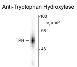 Anti-TPH1 antibody used in Western Blot (WB). GTX82575