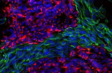 Anti-Peripherin antibody [7C5] used in Immunocytochemistry/ Immunofluorescence (ICC/IF). GTX82614