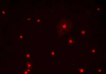 Anti-OLIG1 antibody used in Immunocytochemistry/ Immunofluorescence (ICC/IF). GTX82621