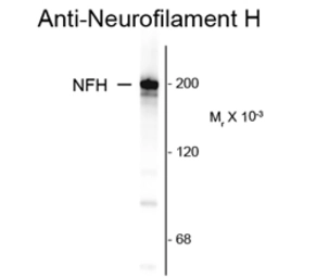Anti-NF-H antibody [NAP4] used in Western Blot (WB). GTX82647
