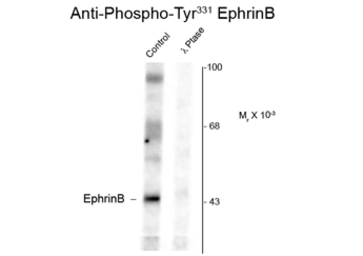 Anti-Ephrin B1 (phospho Tyr344) antibody used in Western Blot (WB). GTX82698