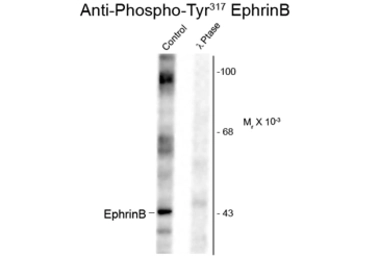 Anti-Ephrin B1 (phospho Tyr329) antibody used in Western Blot (WB). GTX82699
