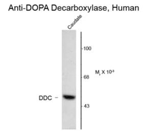 Anti-DOPA Decarboxylase antibody used in Western Blot (WB). GTX82709