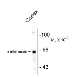 Anti-alpha Internexin antibody used in Western Blot (WB). GTX82742