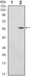 Anti-CD276 antibody [6A1] used in Western Blot (WB). GTX82773