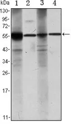 Anti-ALDH1A1 antibody [5A11] used in Western Blot (WB). GTX82775
