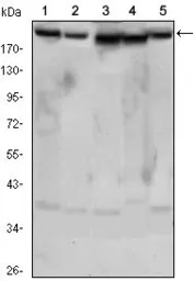 Anti-RICTOR antibody [7B3] used in Western Blot (WB). GTX82789