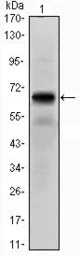 Anti-PTH1R antibody [4D2] used in Western Blot (WB). GTX82794