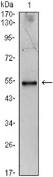 Anti-IL34 antibody [1D12] used in Western Blot (WB). GTX82810