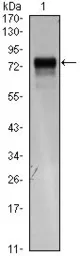 Anti-VEGF Receptor 3 antibody [4H4] used in Western Blot (WB). GTX82824