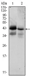 Anti-EpCAM antibody [7E11] used in Western Blot (WB). GTX82831
