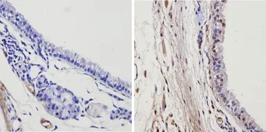 Anti-Thyroid Hormone Receptor alpha-2 antibody used in IHC (Paraffin sections) (IHC-P). GTX82858