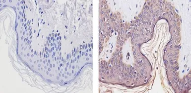 Anti-Thyroid Hormone Receptor alpha-2 antibody used in IHC (Paraffin sections) (IHC-P). GTX82858