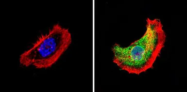Anti-Thyroid Hormone Receptor alpha-2 antibody used in Immunocytochemistry/ Immunofluorescence (ICC/IF). GTX82858