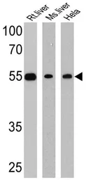 Anti-LXR beta antibody used in Western Blot (WB). GTX82863