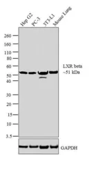 Anti-LXR beta antibody used in Western Blot (WB). GTX82863