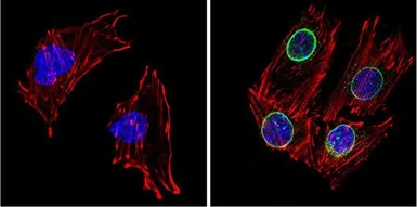 Anti-LXR beta antibody used in Immunocytochemistry/ Immunofluorescence (ICC/IF). GTX82863