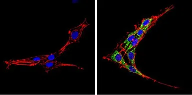 Anti-SREBP2 antibody used in Immunocytochemistry/ Immunofluorescence (ICC/IF). GTX82865