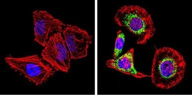 Anti-SREBP2 antibody used in Immunocytochemistry/ Immunofluorescence (ICC/IF). GTX82865