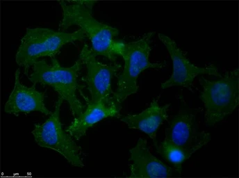 Anti-beta Amyloid antibody used in Immunocytochemistry/ Immunofluorescence (ICC/IF). GTX82974