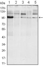Anti-IRE1 alpha antibody [9F2] used in Western Blot (WB). GTX82996