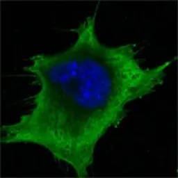 Anti-SOD1 antibody [6F5] used in Immunocytochemistry/ Immunofluorescence (ICC/IF). GTX83012