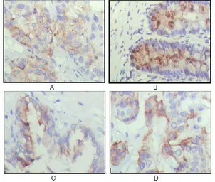 Anti-IGFBP2 antibody [1F6F6] used in IHC (Paraffin sections) (IHC-P). GTX83035