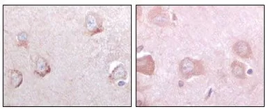 Anti-SorLA antibody [3B6B11] used in IHC (Paraffin sections) (IHC-P). GTX83063