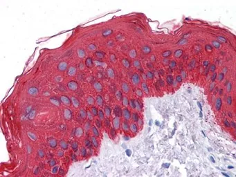 Anti-pan Cytokeratin antibody [7H8C4] used in IHC (Paraffin sections) (IHC-P). GTX83079