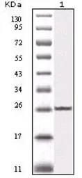 Anti-IKK beta antibody [10A2C5B3] used in Western Blot (WB). GTX83085
