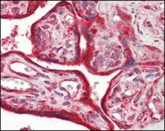 Anti-Calreticulin antibody [1G6A7] used in IHC (Paraffin sections) (IHC-P). GTX83089