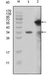 Anti-MLL antibody [10F8D7] used in Western Blot (WB). GTX83091