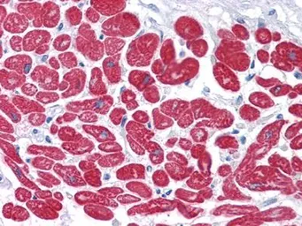 Anti-Myosin Light Chain 3 antibody [7C1] used in IHC (Paraffin sections) (IHC-P). GTX83122