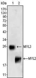 Anti-Myosin Light Chain 3 antibody [3F8] used in Western Blot (WB). GTX83123