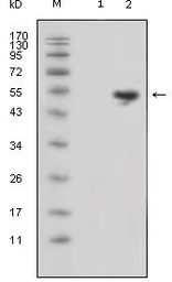 Anti-Lipocalin 1 antibody [10B10] used in Western Blot (WB). GTX83128